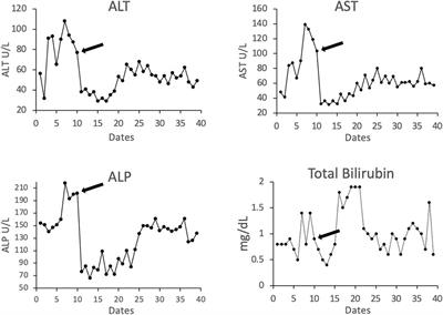 Antibody-Mediated Rejection in Liver Transplantation: Immuno-Pathological Characteristics and Long-Term Follow-Up